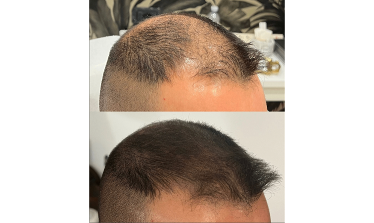 Questo diradamento è al limite per realizzare un effetto densità.