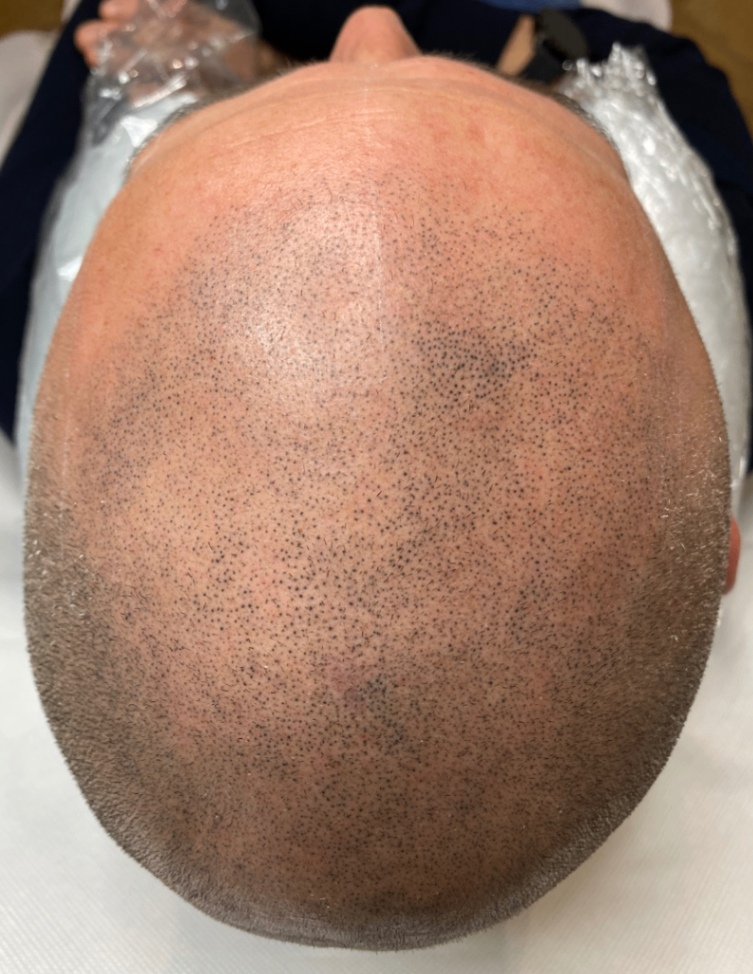 trattamento altro operatore pronto per il recupero