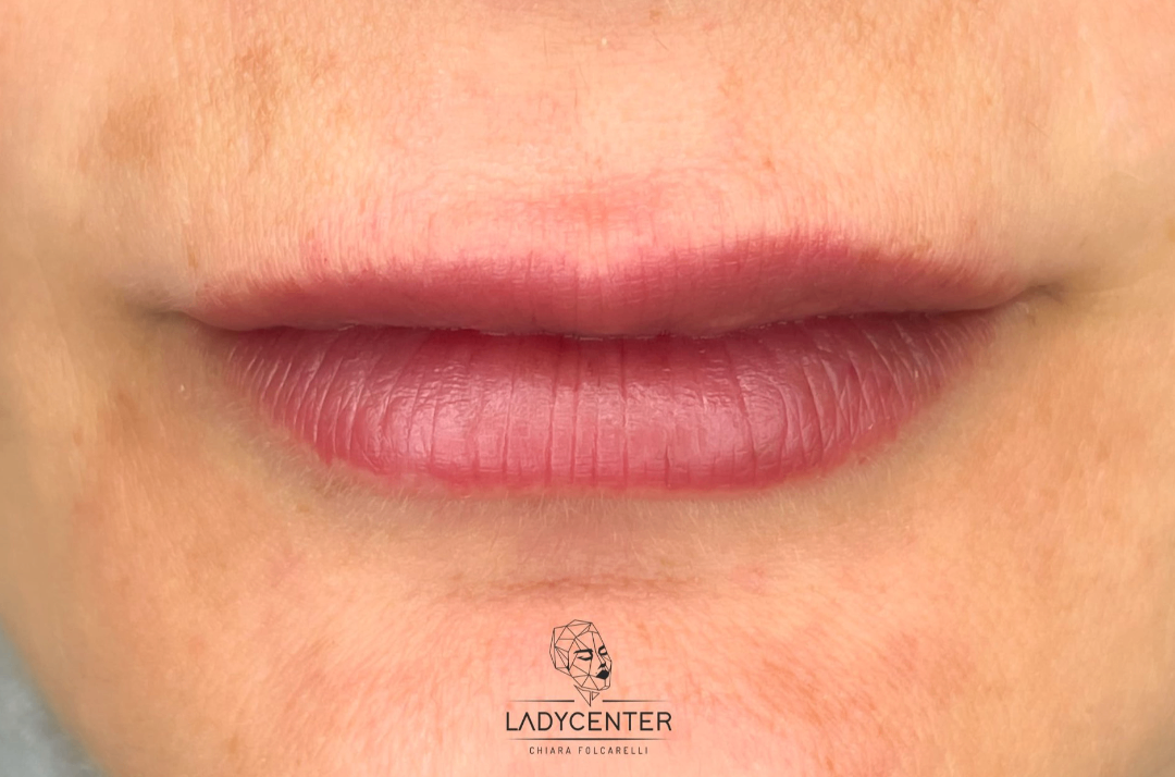 labbra dermopigmentazione trucco semi permanente asimmetria